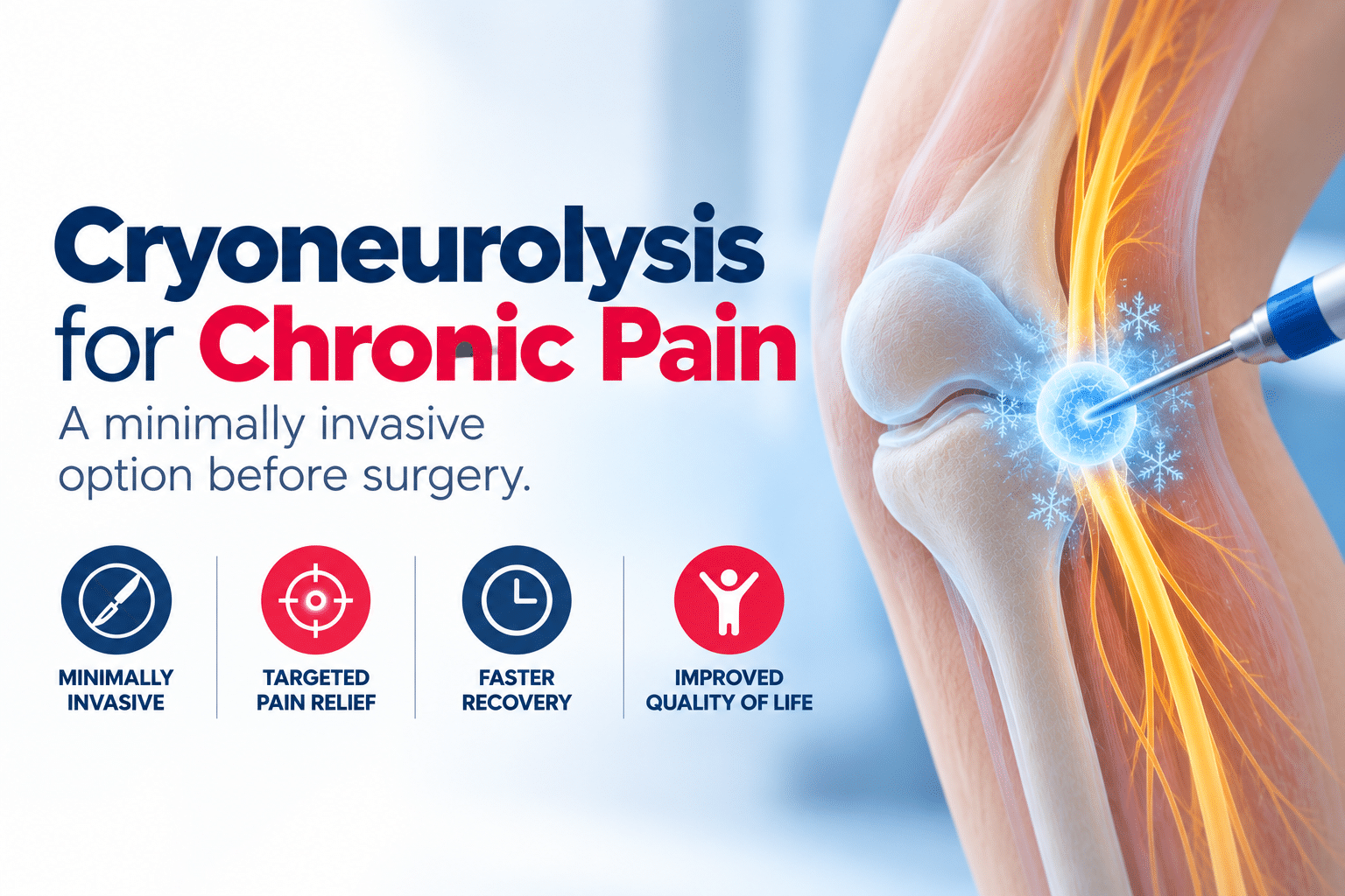 Cryoneurolysis for Chronic Pain