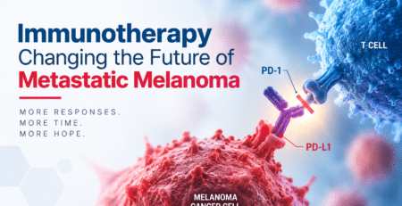 Metastatic Melanoma Immunotherapy