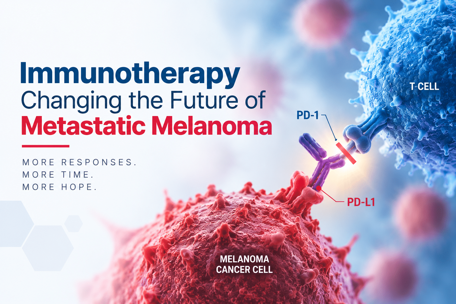 Metastatic Melanoma Immunotherapy